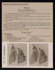 Thorax. Heart and Pericardium - no. 3
